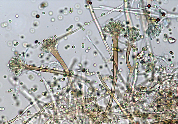 Aspergillus. Credit: Cornell Fungi / Flickr